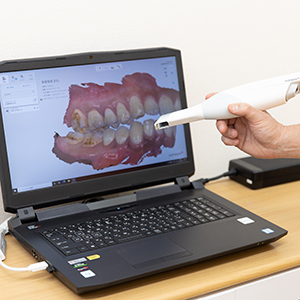 口腔内スキャナー「TRIOS3」
